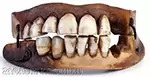 Зубы Ватерлоо